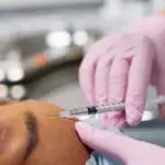 Detailed view of a cosmetic injection procedure being performed in a clinical setting.